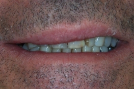 case_0_image_80.jpg"