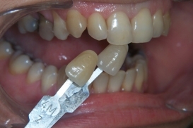 case_0_image_81.jpg"