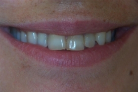 case_0_image_82.JPG"