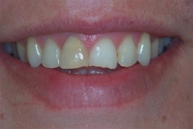 case_0_image_83.JPG"