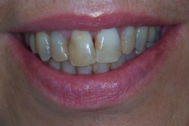 case_0_image_84.JPG"