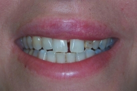 case_0_image_85.JPG"