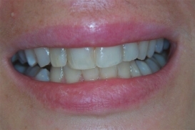 case_0_image_86.JPG"