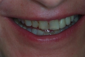 case_0_image_87.JPG"