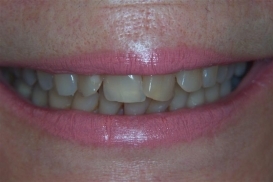 case_0_image_88.JPG"
