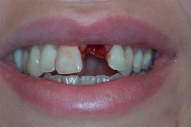 case_0_image_90.JPG"