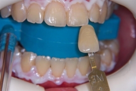 case_0_image_91.jpg"