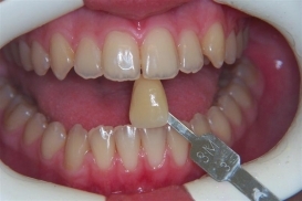 case_0_image_92.JPG"