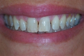 case_0_image_93.JPG"