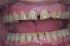 case_0_image_94.jpg"