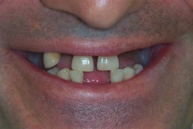 case_0_image_95.JPG"
