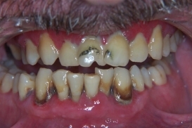 case_0_image_96.jpg"