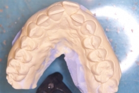 case_0_image_97.jpg"