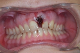 case_0_image_98.jpg"