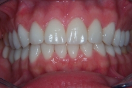 case_1_image_15.jpg"