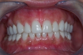 case_1_image_18.jpg"