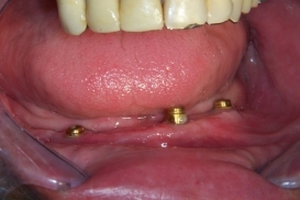 case_1_image_23.jpg"