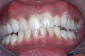 case_1_image_26.jpg"