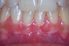 case_1_image_28.jpg"