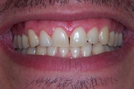 case_1_image_31.jpg"