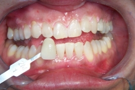 case_1_image_33.jpg"
