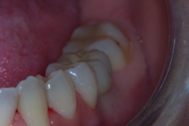 case_1_image_35.jpg"