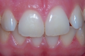 case_1_image_36.jpg"