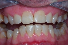 case_1_image_38.jpg"
