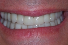 case_1_image_39.jpg"