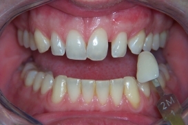 case_1_image_41.jpg"