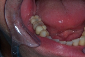 case_1_image_43.jpg"