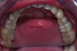 case_1_image_44.jpg"