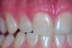 case_1_image_45.jpg"