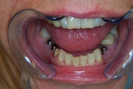 case_1_image_49.jpg"
