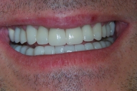 case_1_image_50.jpg"