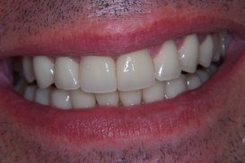case_1_image_51.jpg"