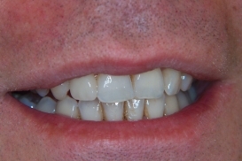 case_1_image_52.jpg"