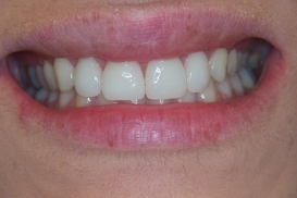 case_1_image_53.jpg"