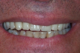 case_1_image_55.jpg"