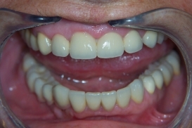case_1_image_56.jpg"