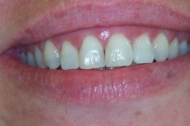 case_1_image_57.jpg"