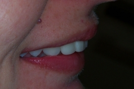 case_1_image_60.jpg"