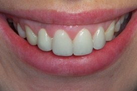 case_1_image_61.jpg"