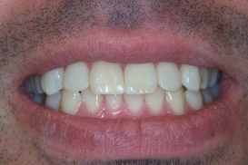 case_1_image_69.jpg"