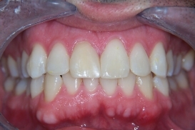 case_1_image_70.jpg"