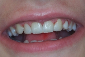 case_1_image_71.jpg"