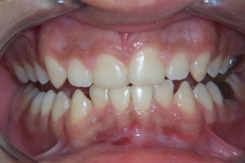 case_1_image_72.jpg"