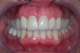 case_1_image_73.jpg"