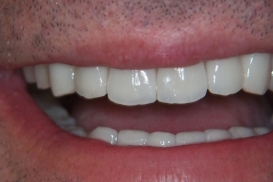 case_1_image_80.jpg"