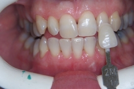 case_1_image_81.jpg"